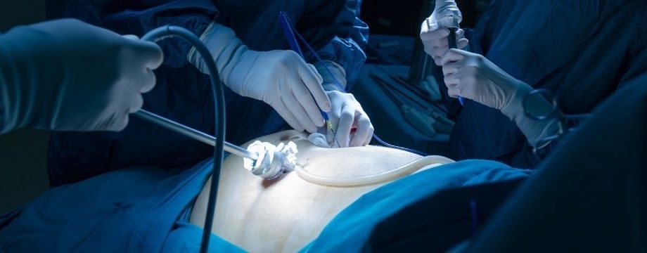 Inguinal Hernia Treatment In Guwahati