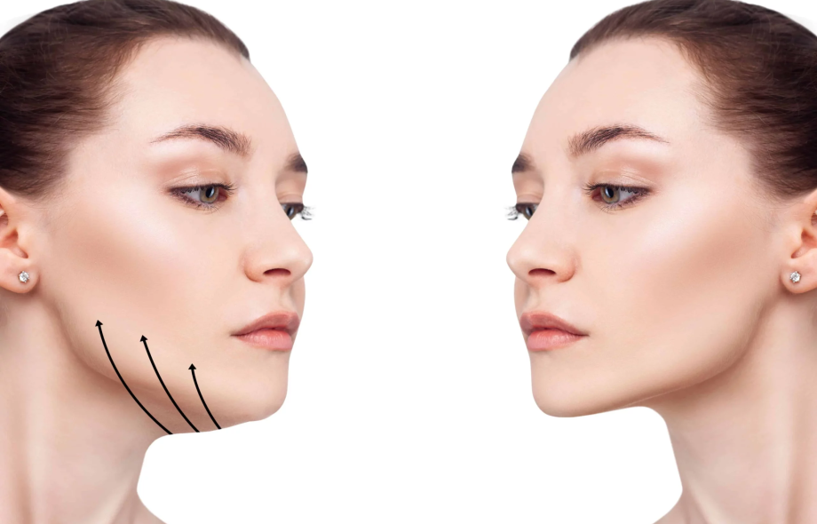 Double Chin Removal Non-Invasive Treatments That Deliver Results