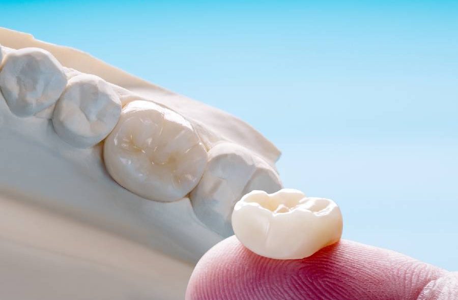 dental crowns chippewa falls