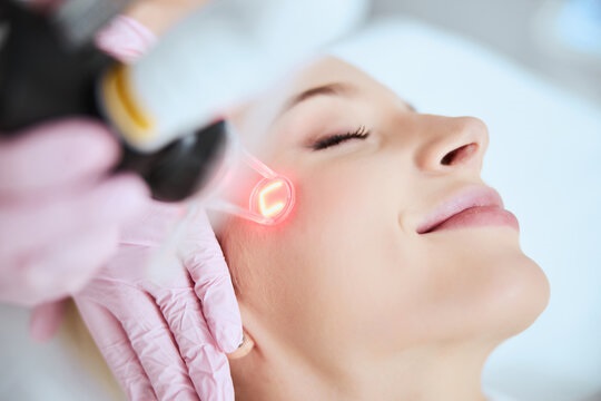 Laser Treatment Dubai
